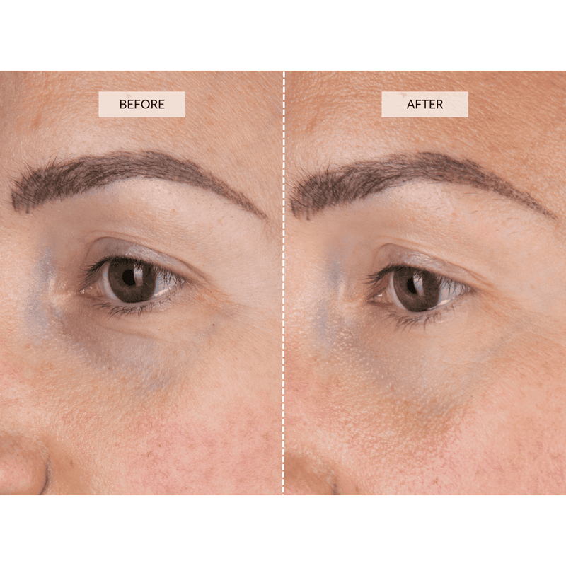 CurrentBody Skin LED Eye Perfector Hotsell