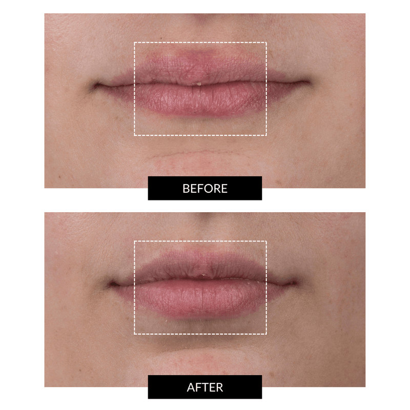 CurrentBody Skin LED Lip Perfector Negozio