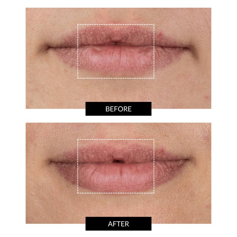 CurrentBody Skin LED Lip Perfector Negozio