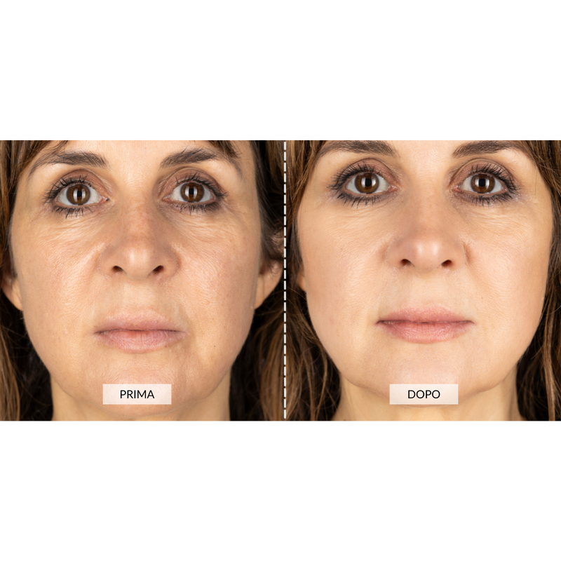 CurrentBody Skin Dispositivo a radiofrequenza per il viso RF Currentbody Skin Nuova