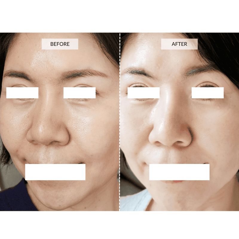 CurrentBody Skin Maschera viso LED 4-in-1 con mappatura a zone Currentbody Skin 2025