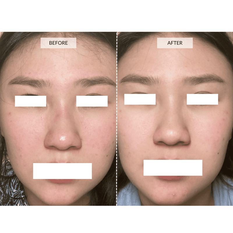 CurrentBody Skin Maschera viso LED 4-in-1 con mappatura a zone Currentbody Skin 2025