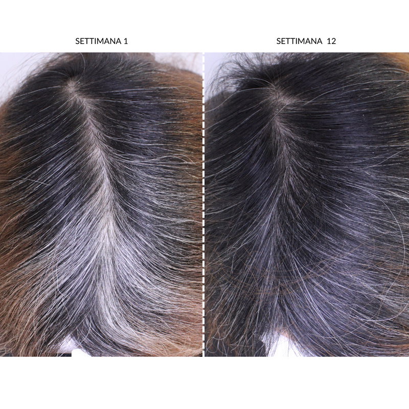 CurrentBody Skin Dispositivo LED Per la Ricrescita dei Capelli Nuovo