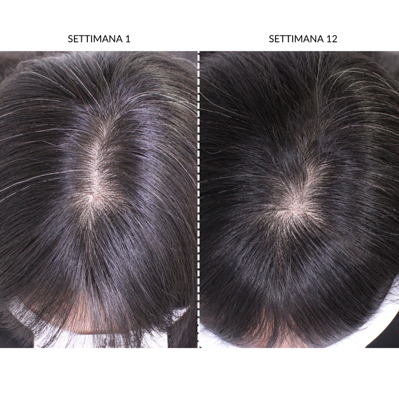 CurrentBody Skin Dispositivo LED Per la Ricrescita dei Capelli Nuovo