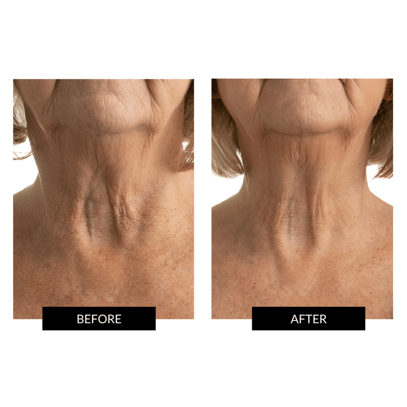 CurrentBody Skin Maschera Collo e Décolleté Vendita