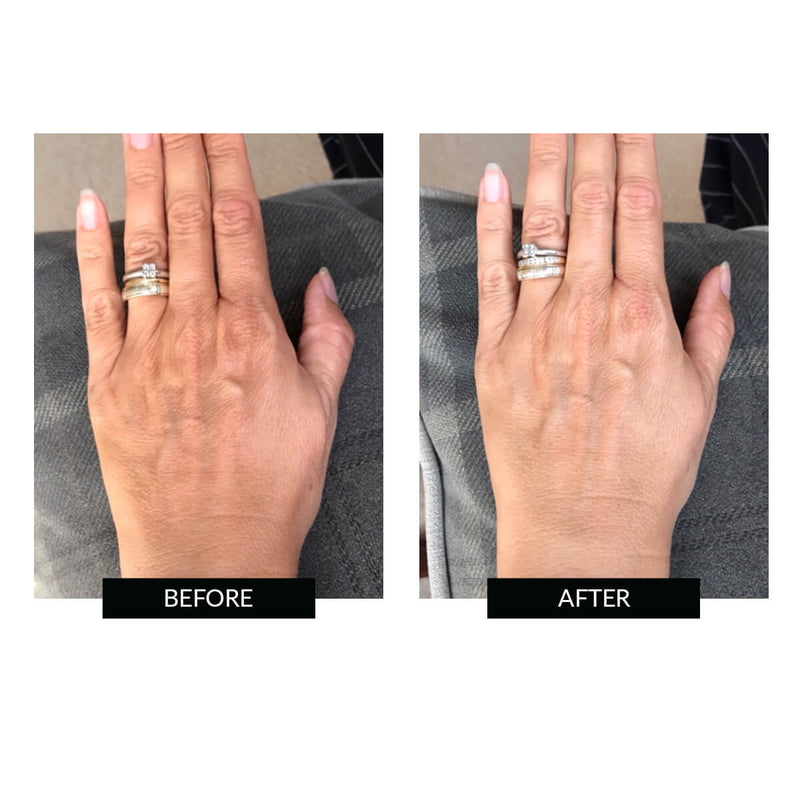 CurrentBody Skin Offers CurrentBody Skin LED Hand Perfector Offerta Consegna Veloce