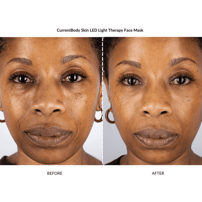 CurrentBody Skin Kit Illuminante e Rimpolpante x ZIIP Affare Del Giorno