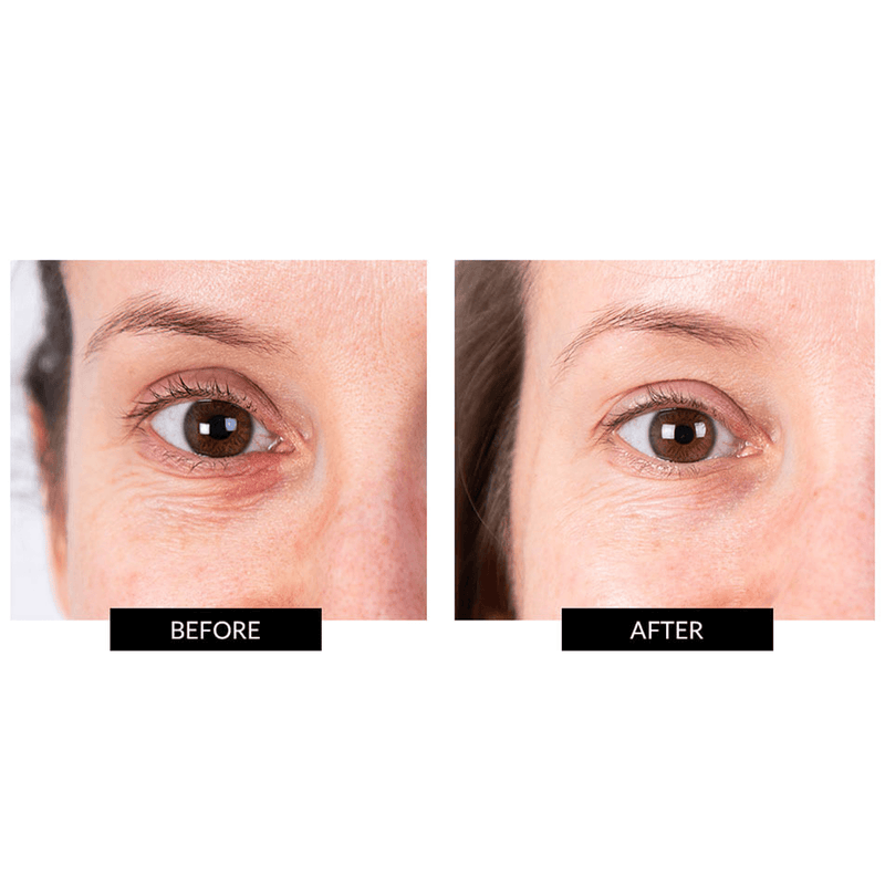 CurrentBody Skin LED Eye Perfector & 5 Eye Hydrogel Masks (del valore di 249€) Sconto