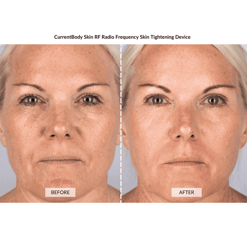 CurrentBody Skin Kit Viso Anti-età completo Negozio