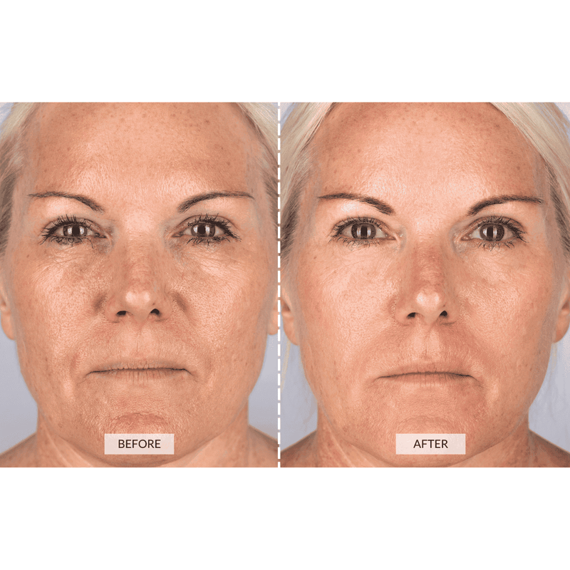 CurrentBody Skin Dispositivo a radiofrequenza RF x Sonia Sélaire Nuova