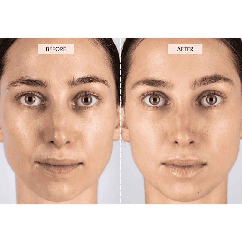 CurrentBody Skin Set Regalo Beauty LED Sottocosto