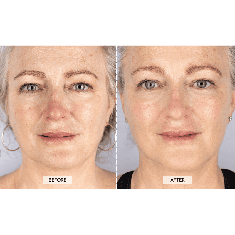 CurrentBody Skin Set Regalo Beauty LED Sottocosto