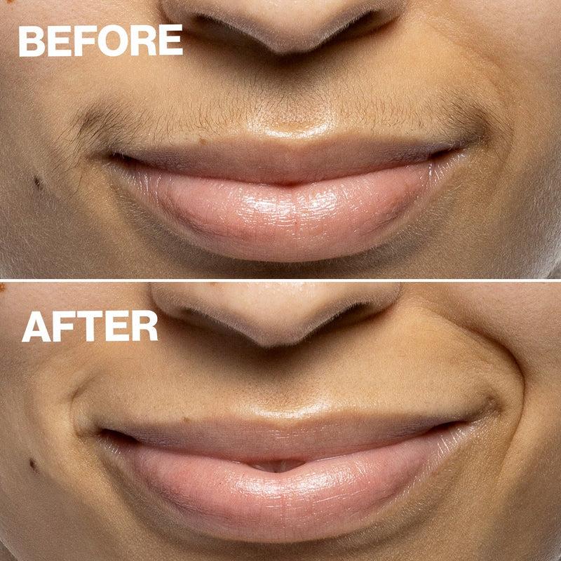 DERMAFLASH Dispositivo di Epilazione Mini Precision Peach Fuzz Outlet