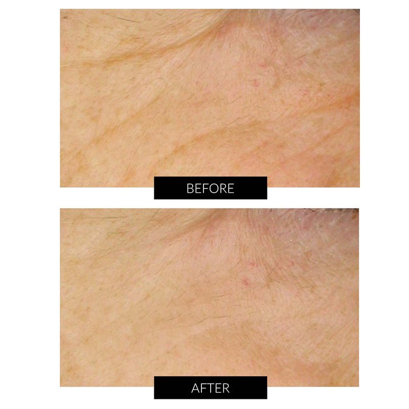 Dr Levy Set Stem Cell Miracle Trial (del valore di 495€) Soddisfazione Garantita