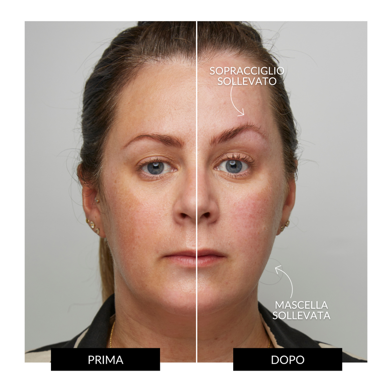 CurrentBody Skin Offers Dispositivo Tonificante Facciale ZIIP HALO Offerta Offerte