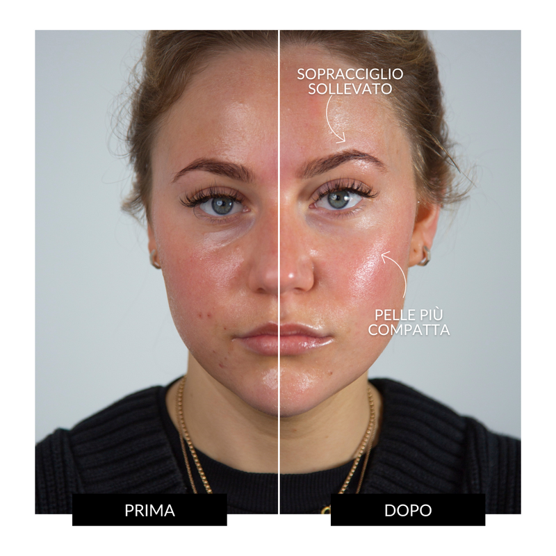 CurrentBody Skin Offers Dispositivo Tonificante Facciale ZIIP HALO Offerta Offerte