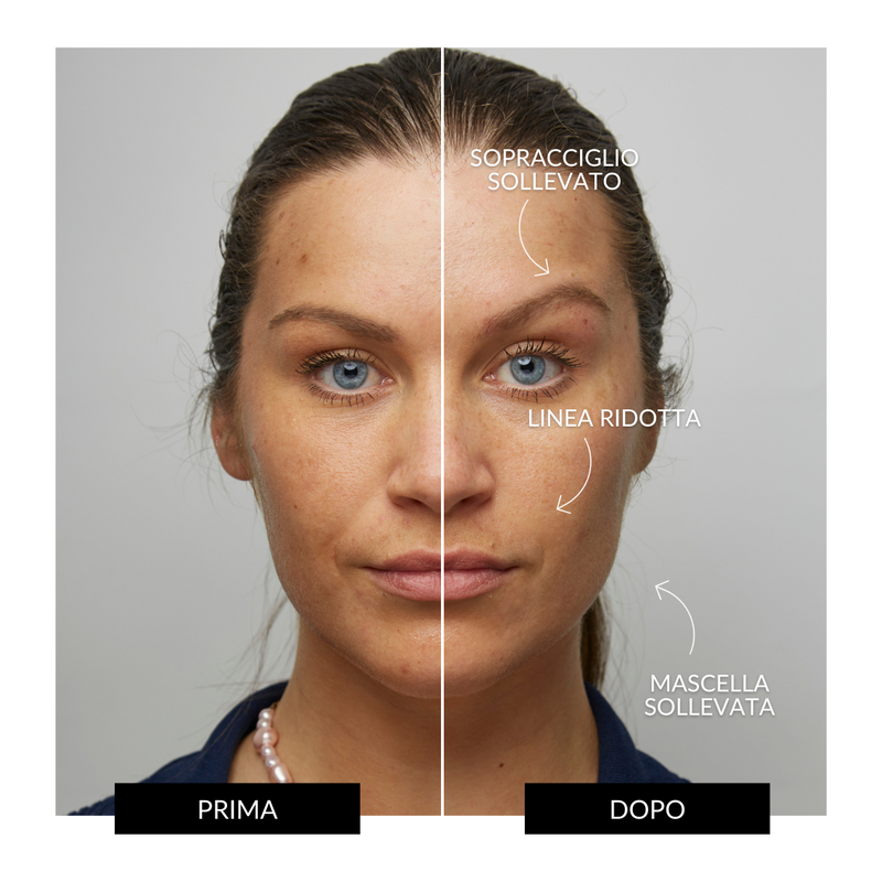 CurrentBody Skin Offers Dispositivo Tonificante Facciale ZIIP HALO Offerta Offerte