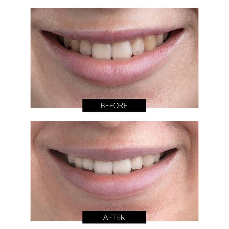 CurrentBody Skin Offers CurrentBody Skin Kit Sbiancamento Denti LED Offerta Shopping Online