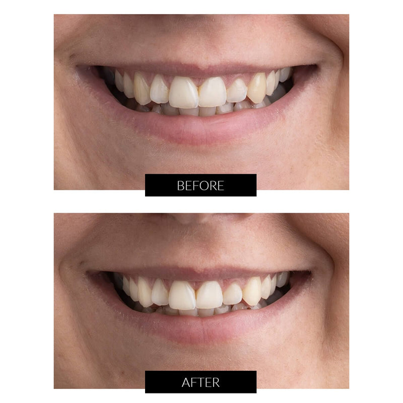 CurrentBody Skin Offers CurrentBody Skin Kit Sbiancamento Denti LED Offerta Shopping Online