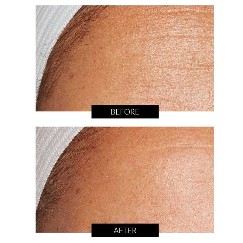 Lancer Skincare The Method: Nourish Normal-Combination Skin (50ml) Outlet