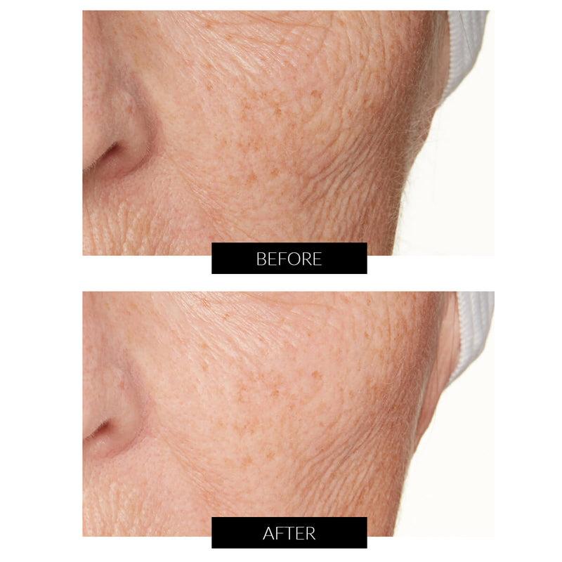 Lancer Skincare Maschera Radiance Awakening con LES-10 (30ml) I Più Venduti