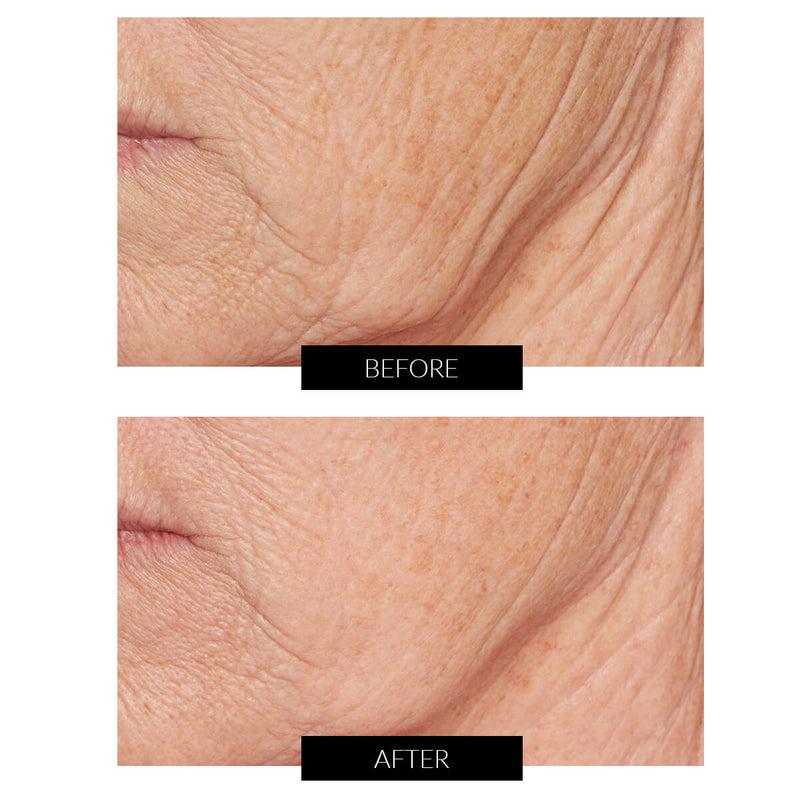 Lancer Skincare Trattamento Illuminante Advanced C (50ml) Vendite Flash