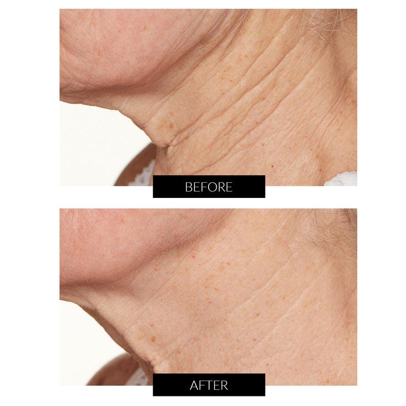 Lancer Skincare Trattamento Notte Intensivo con Hylaplex e Olio di Marula (50ml) Negozio